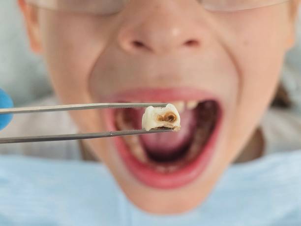 Best Walk-In Emergency Dentist in Panther Valley, NJ